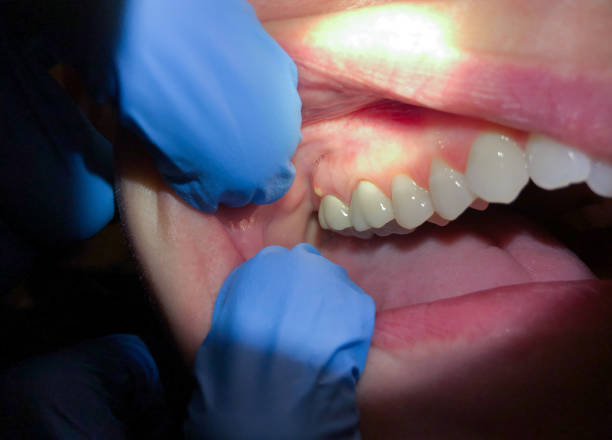 Best Broken Tooth Emergency  in East Hampton North, NY